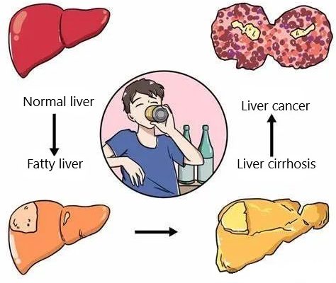 Liver glutathione levels