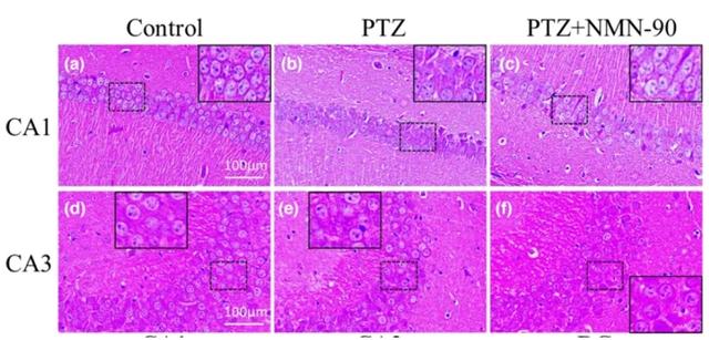 NMN improved neuronal morphology and increased neuronal number in epileptic mice
