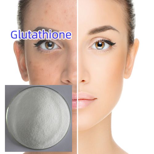 Glutathione is a whitening agent that can delay aging