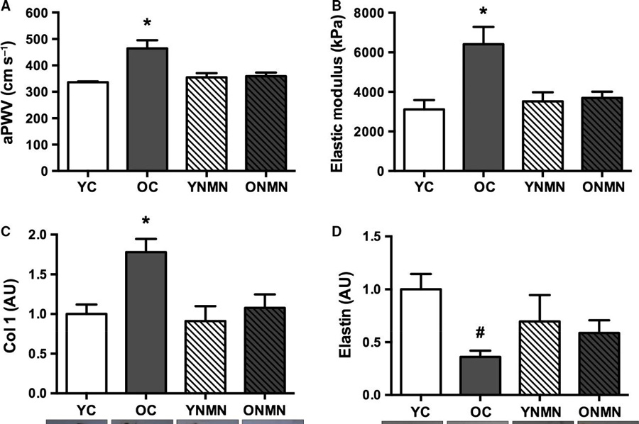 NMN can treat aortic stiffness